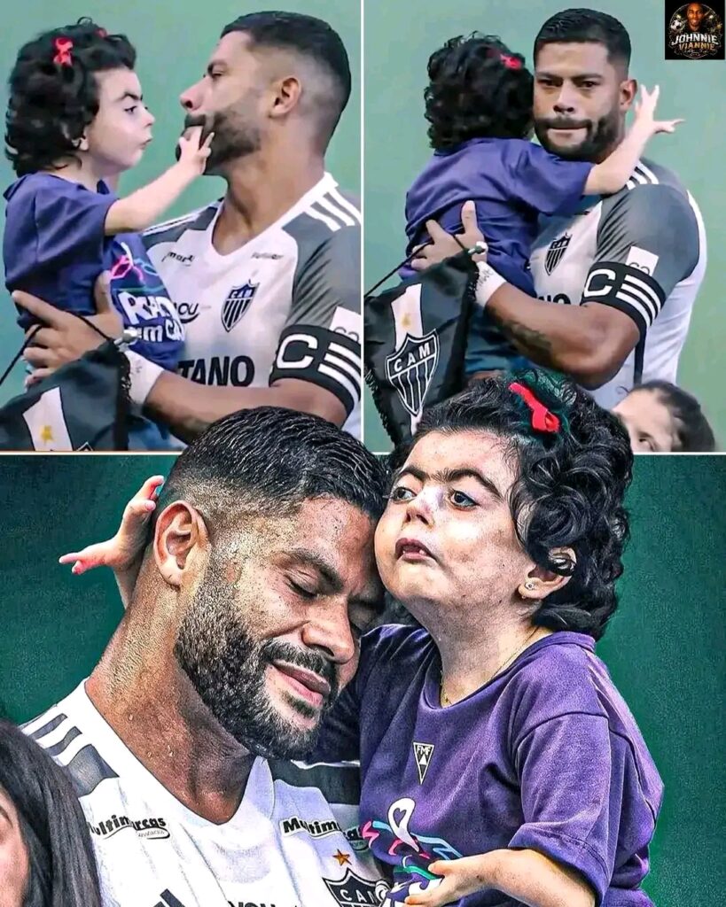 **❤️ SO SCHÖN IST FUSSBALL!** 🥹⚽ Vor dem großen Mineiro-Derby betraten Hulk und die Spieler von Atlético Mineiro gemeinsam mit Kindern, die am Cornelia-de-Lange-Syndrom leiden, den Rasen. Mit dieser berührenden Geste setzten sie ein starkes Zeichen für Sichtbarkeit, Aufmerksamkeit und echte Inklusion. Besonders herzerwärmend: die emotionalen Momente zwischen Hulk und der kleinen Mariazinha. Pure Menschlichkeit! 🙏📸
